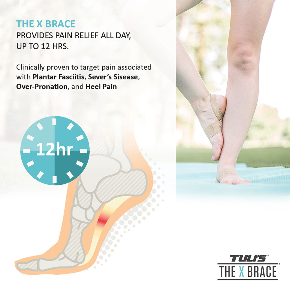 illustration of a foot with plantar fasciitis